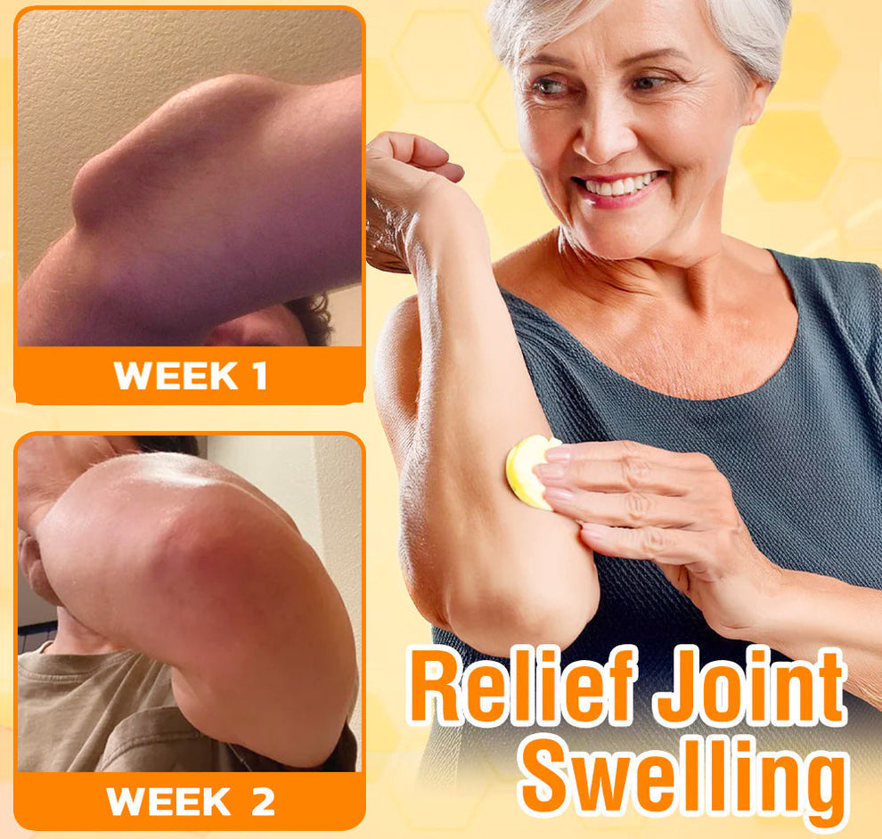 🇺🇸Bee Power Recovery Cream – Swift Relief for Body Discomfort⏰Limited Sale Buy 1 Get 1 FREE⏰