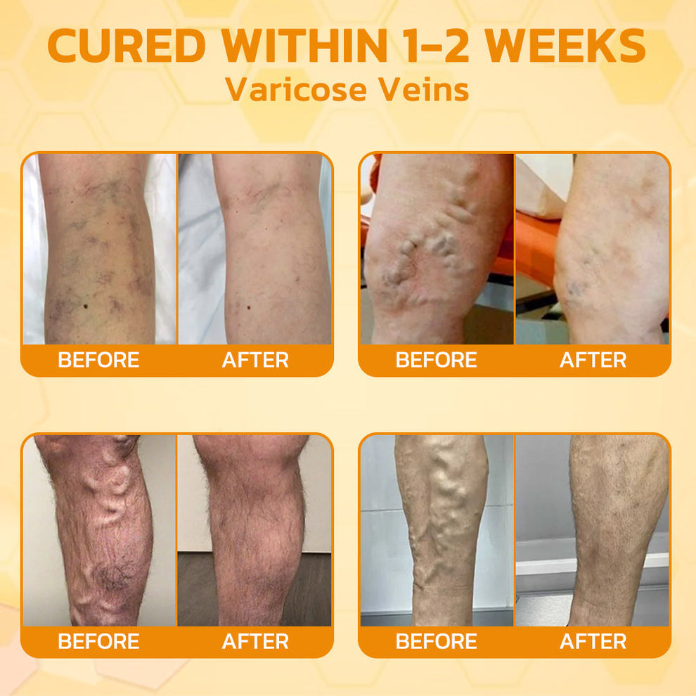 🇺🇸Bee Power Recovery Cream – Swift Relief for Body Discomfort⏰Limited Sale Buy 1 Get 1 FREE⏰