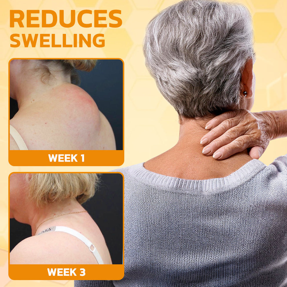 🇺🇸Bee Power Recovery Cream – Swift Relief for Body Discomfort⏰Limited Sale Buy 1 Get 1 FREE⏰