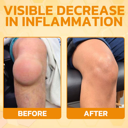 🇺🇸Bee Power Recovery Cream – Swift Relief for Body Discomfort⏰Limited Sale Buy 1 Get 1 FREE⏰
