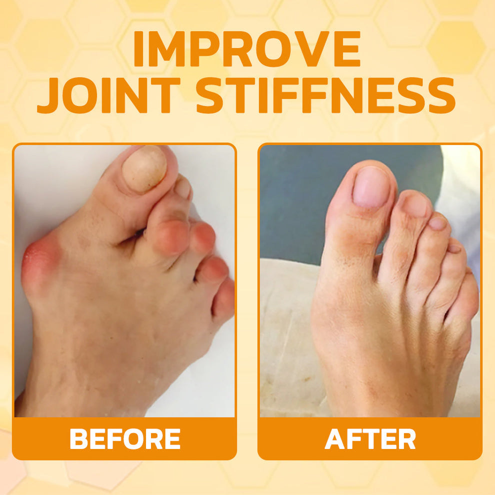 🇺🇸Bee Power Recovery Cream – Swift Relief for Body Discomfort⏰Limited Sale Buy 1 Get 1 FREE⏰